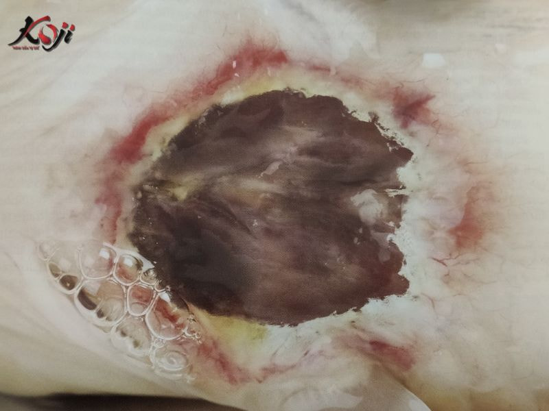 bệnh lở loét ở cá koi