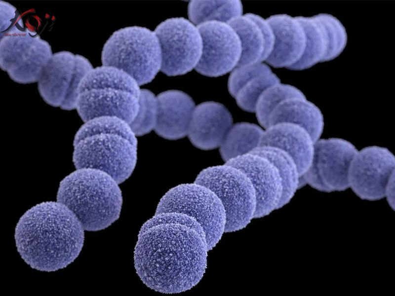 bệnh lòi mắt cá Koi