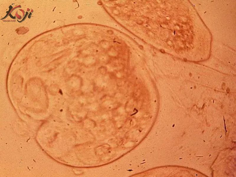 ký sinh trùng đơn bào costia